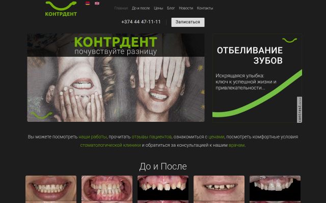 Screenshot of contrdent.com