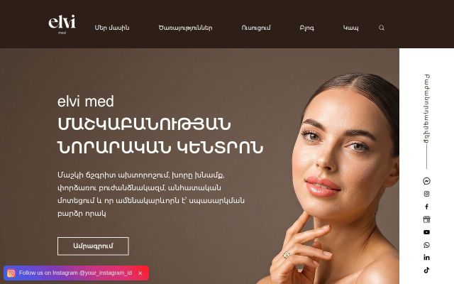 elvimed.am - էկրանի պատկեր
